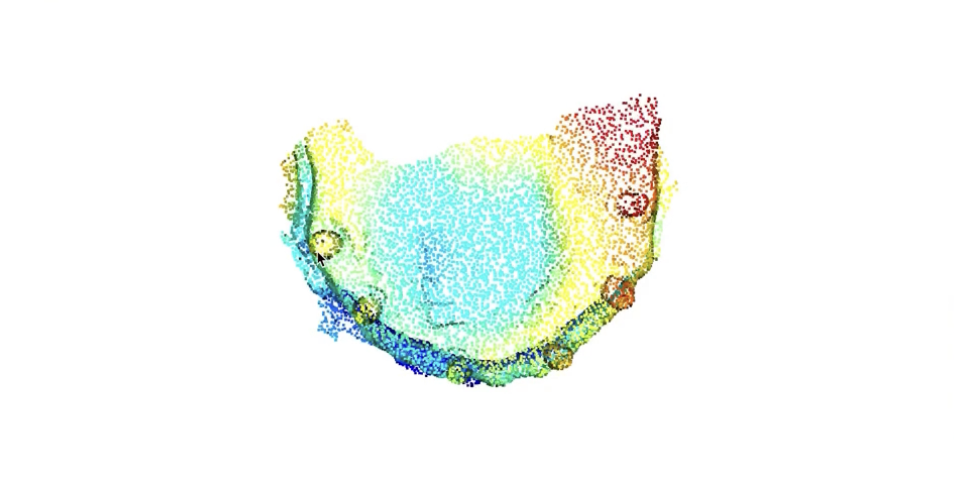 3D Object Alignment on Teeth Structure
